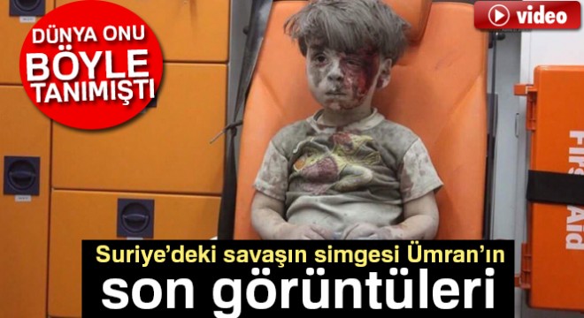 Suriye'deki savaşın simgesi Ümran'ın son görüntüleri